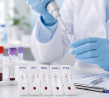  NVSC kviečia pasitikrinti dėl ŽIV, LPI ir virusinių hepatitų